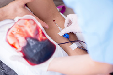 Patient getting blood transfusion in hospital clinic