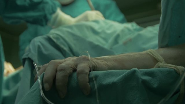 Hand close up of elderly patient who lying on table under anesthesia, surgery procedure in operation room, focus change on surgeons hands in protective gloves using surgical tools to operating man.