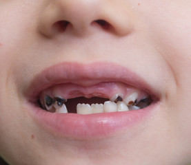 Obraz premium Baby mouth