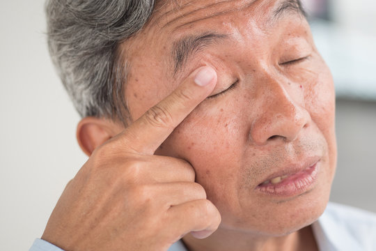old man with eye irritation, optical problem