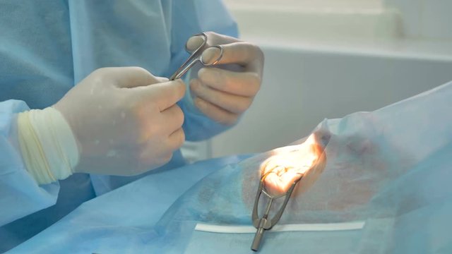 A brightly lit eye widened by speculum during surgery.