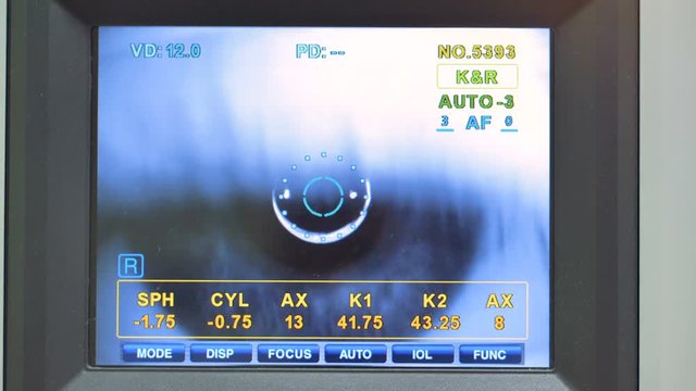 An autorefractometer testing each human eye in turn. 