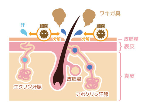 ワキガ臭発生の原因イラスト (腋臭・わきが）/日本語・説明文なし