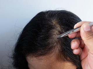 Woman's hand with tweezers plucking gray hair roots