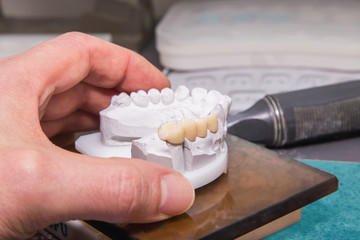 Obraz na płótnie Canvas Technical shots of model on a dental prothetic laboratory