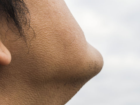 Close Up On Man Cheek And Neck Texture Of Skin With Goose Bump