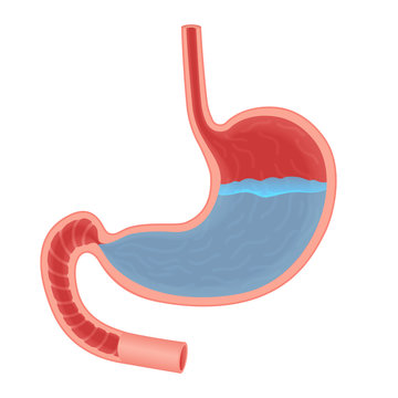 Vector Medical illustration about acid in stomach isolated. Stomach acid reflux, gastric acid. Water fluid.