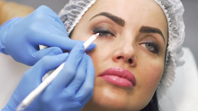 Beautician marks facial zone for botox procedure