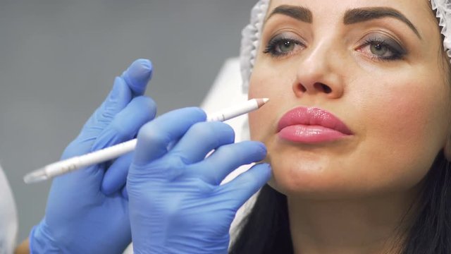 Doctor marks facial zones for botox procedure