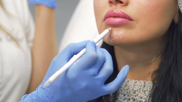 Beautician marks chin zone for botox procedure