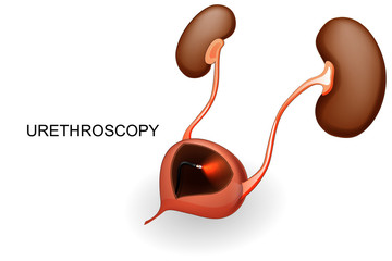 bladder and kidneys. urethroscopy.