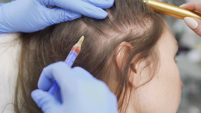 Painful mesotherapy procedure