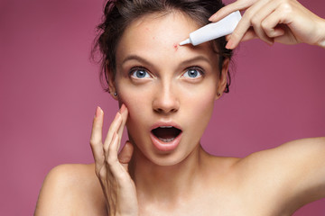Young girl in shock of her acne. Photo of ugly girl with problem skin applying treatment cream on...