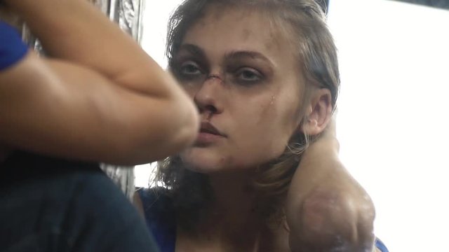 A girl with wounds and cuts stroking her hair near the mirror
