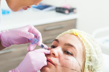 Close-up of a dark-haired woman an Asian beautician injecting a syringe for injection of Botox into the cheekbones of a young woman to adjust the shape in the medical office
