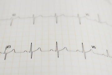 The image of sinusoid