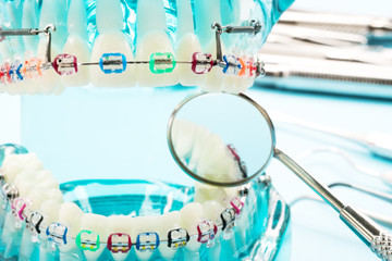 orthodontic model and dentist tool - demonstration teeth model of varities of orthodontic bracket...