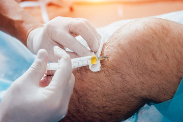 Platelet-rich plasma injection of the knee