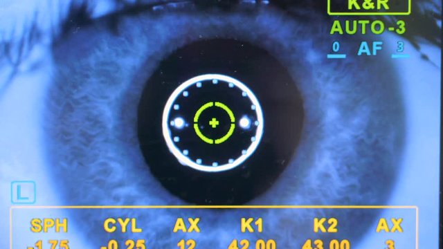 A data screen showing progress of an eye examination. 