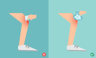 wrong and right ways first aid of using cold packs for injury, illustration
