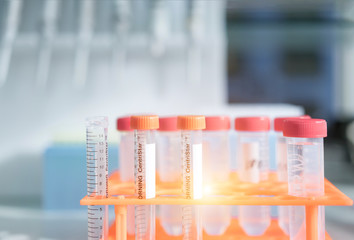 Test tubes with closeup view