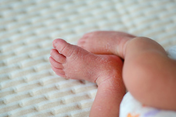 Close-up feet of a newborn with peeling skin.