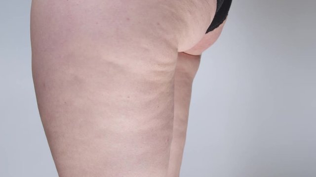 SLOW MOTION CLOSE UP Female revealing cellulite on her thighs and buttocks by standing still in her underwear under bright studio lights. Unhealthy fatty tissue building up on overweight female's legs