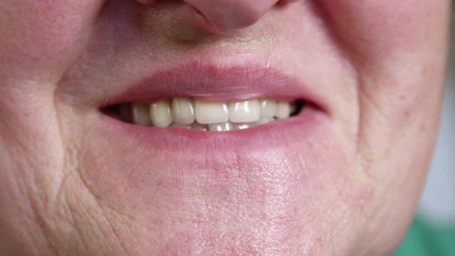 SLOW MOTION, CLOSE UP: Elderly Caucasian lady smiles and shows her shiny dentures. Unknown senior woman laughing and revealing her smiling wrinkles. Close up of deep smile lines around grandma's mouth