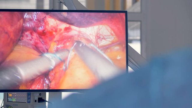 Surgeon uses medical robot at modern clinic. Innovative medicine concept.