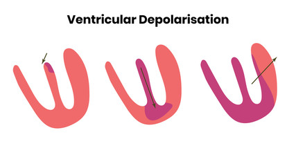 The process of ventricular depolarisation
