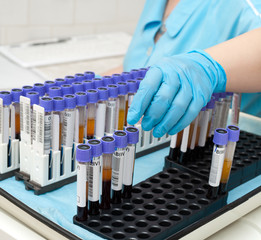 test tubes with blood