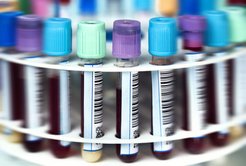rack of blood tubes with samples in centrifuge / tray with tubes and samples in workbench of the...