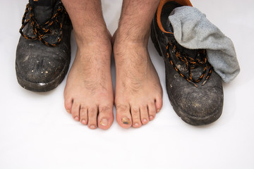 excessive wearing of working footwear as the cause of nail diseases, showing diseased nails on a clean white cotton fabric