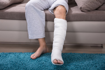 Man's Plastered Leg On Carpet