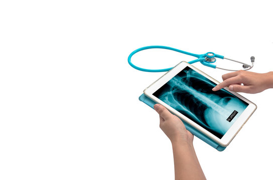 x-ray picture in tablet