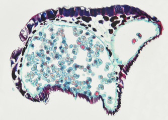 Plant tissue