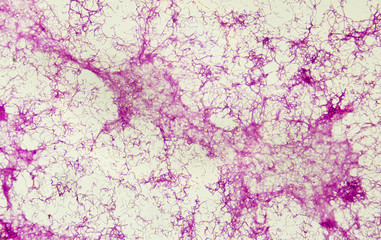 Actinomycetes under the microscope