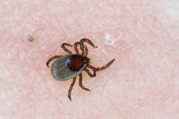Tick Ixodes ricinus on human skin. tick wandering over human hand. Encephalitis tick. This kind of animal is a spreader of borrelia and tbe.