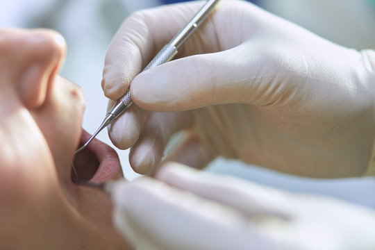 Ragazza dal dentista per igiene dentale