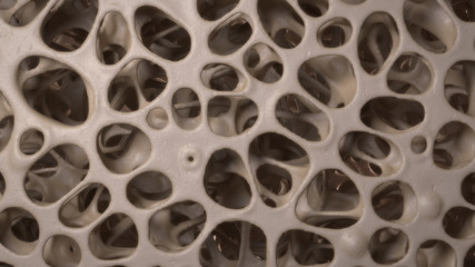 3D CG rendered image of osteoporosis bone micro structure