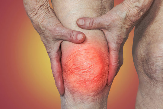 Senior woman holding the knee with pain