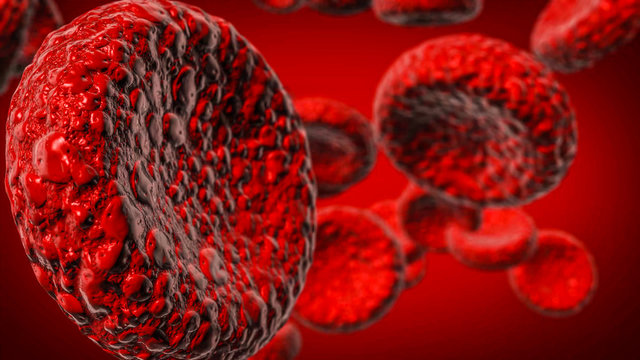 Realistic cancerous blood cells floating in plasma. Rendered image