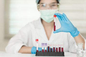 Female Technician holding blood tube test, a rack of  blood samples Tubes of patients in laboratory in the hospital.