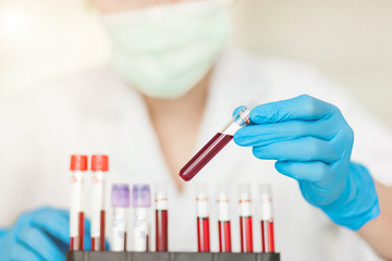 Female Technician work on blood tube test, a rack of  blood samples Tubes of patients in laboratory in the hospital.