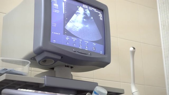 doctor's monitor ultrasound in 4k