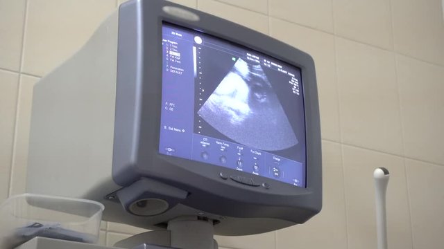 Footage Ultrasonography of pregnancy woman in 4k