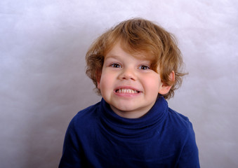 malocclusion of the boy