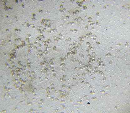 Chlamydomonas algae, paramecium ciliates and many bacteria through microscope