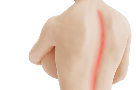 Back pain concept - Beautiful nude woman with huge boobs has back pain