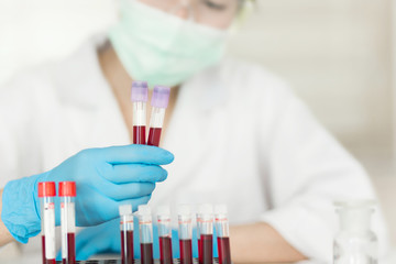Female Technician holding blood tube test, a rack of  blood samples Tubes of patients in laboratory in the hospital.